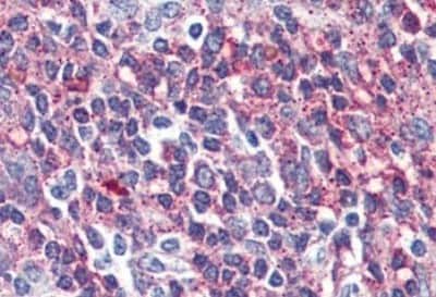 Immunohistochemistry-Paraffin: VIPR2/VPAC2 Antibody [NBP3-14515]